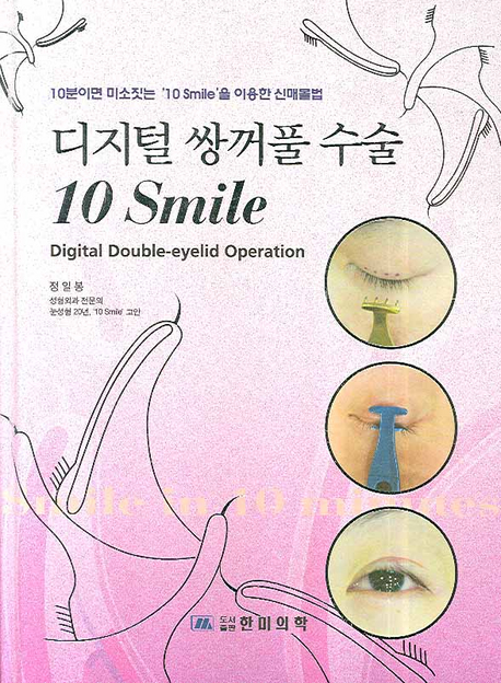 디지털 쌍꺼풀 수술 (10 SMILE) 