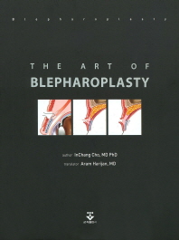 The Art of Blepharoplasty
