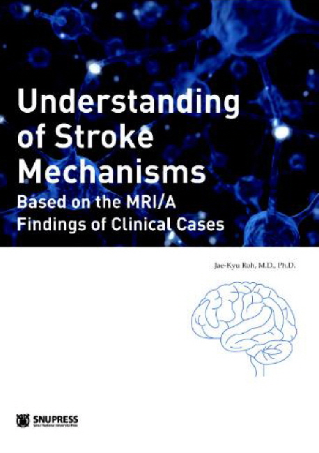 Understanding of Stroke Mechanisms