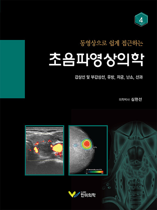 초음파영상의학 4 갑상선 및 부갑상선, 유방, 자궁, 난소, 산과